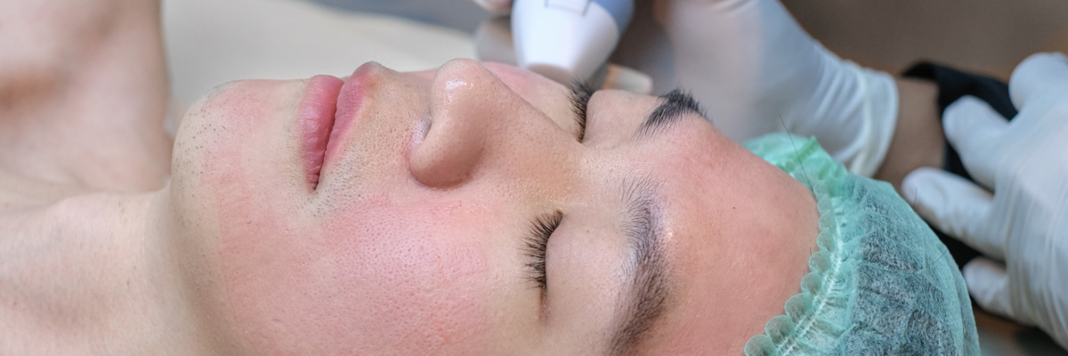 Exion Procedure