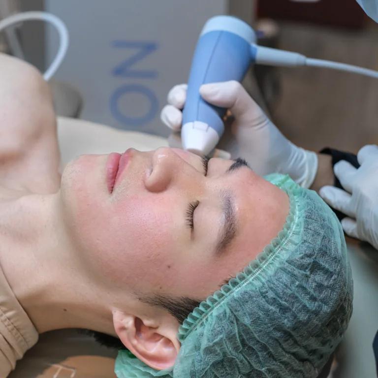 Exion Procedure
