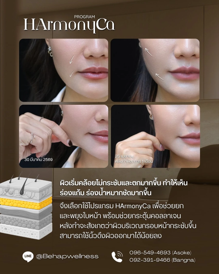ภาพระยะใกล้และการติดตามผิวของผู้รับบริการโปรแกรม HArmonyCa คนเดียวกัน จากโพสต์ BEHAP