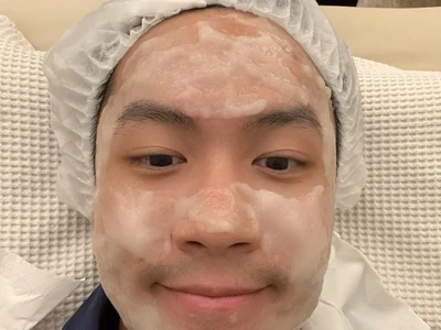 A person wearing a disposable hair cover with facial skincare patches.