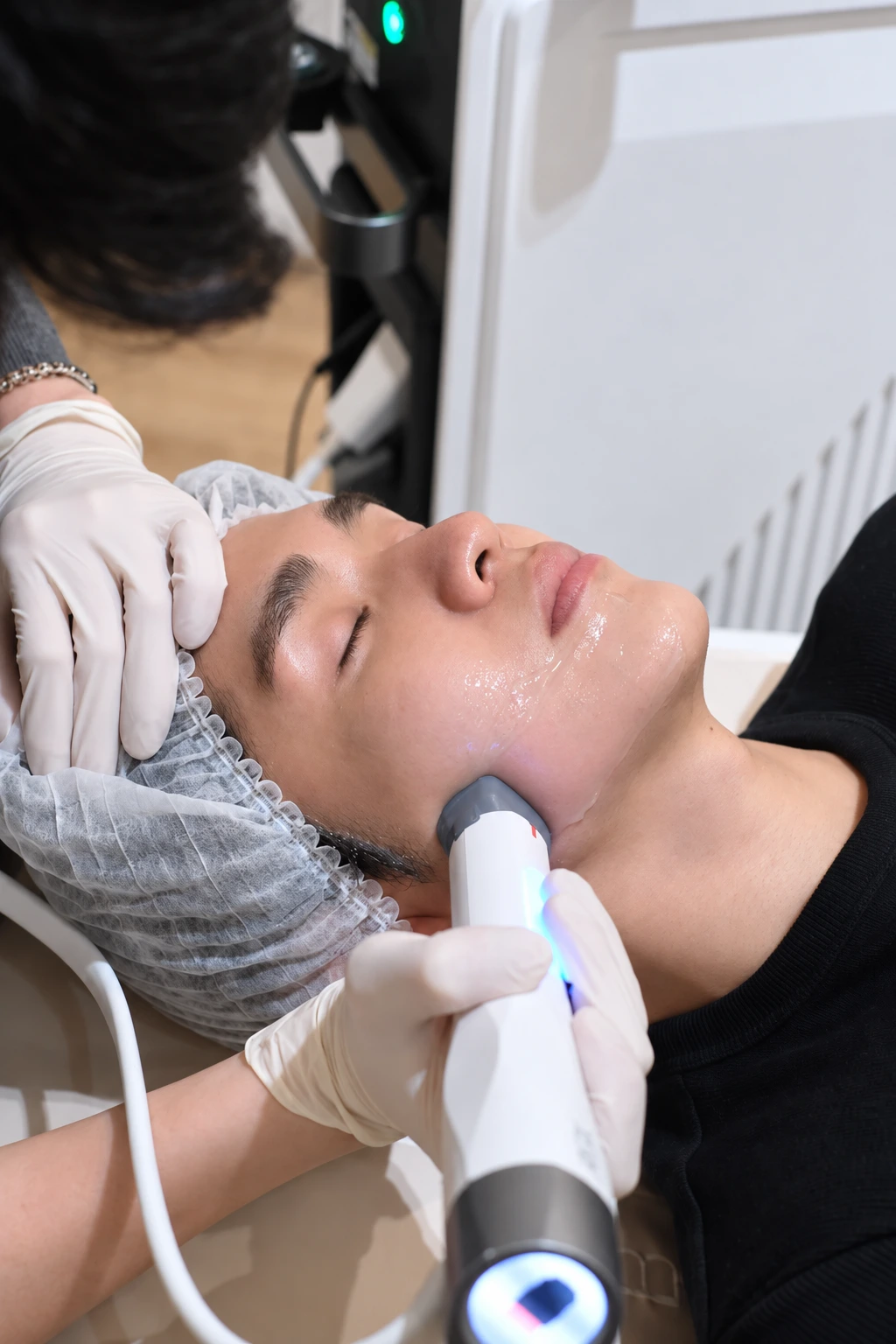XERF treatment image