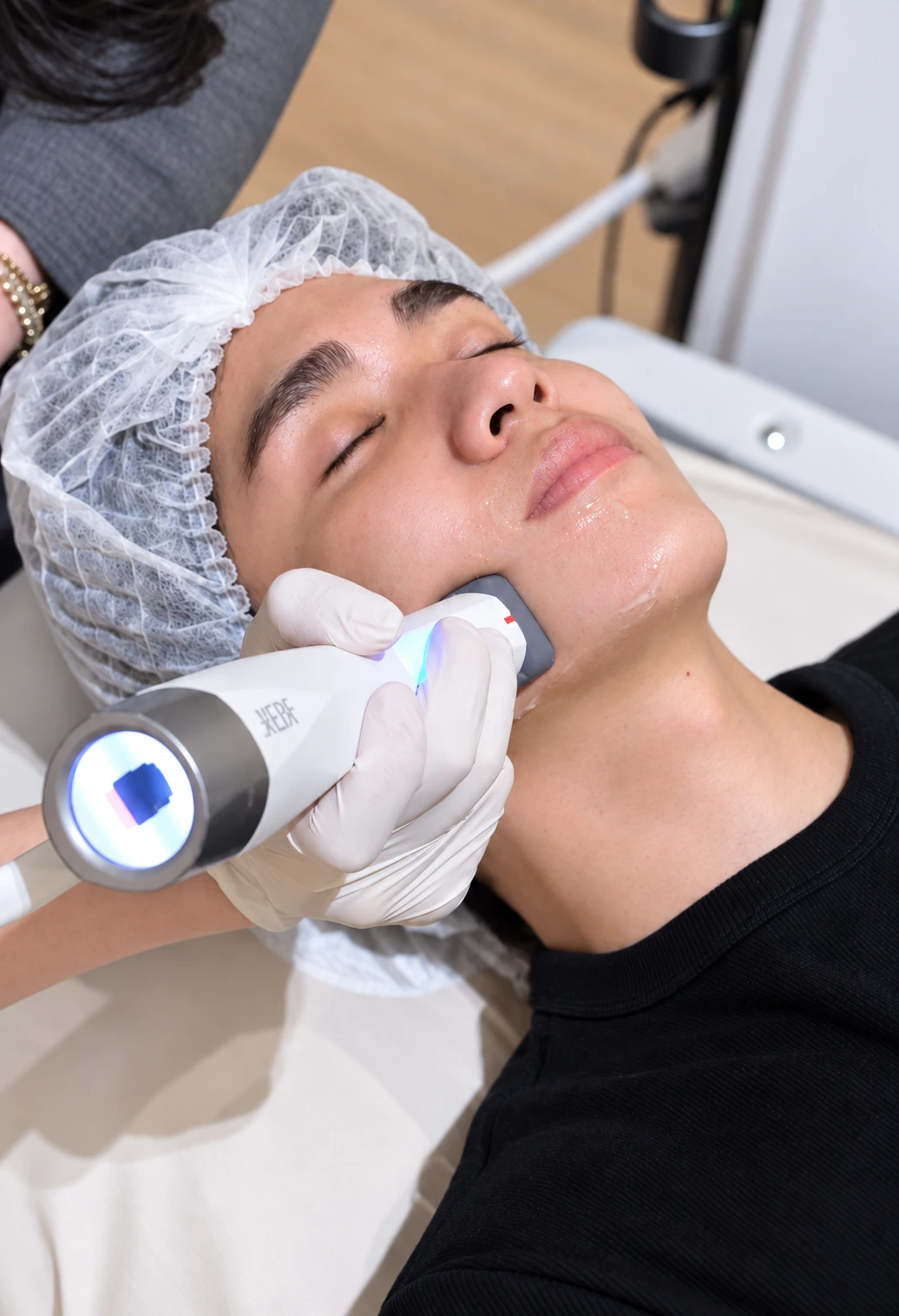 XERF treatment image
