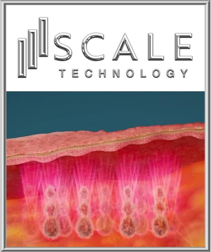 ภาพจำลอง SCALE แสดงรูปแบบพลังงานที่มากกว่าในชั้นลึกและลดลงสู่ชั้นตื้น